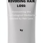 Hair Loss Guide for Men Amazon Kindle eBook 34 Page Solutions-0