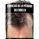Spanish Hair Loss Prevention Guide for Men-0
