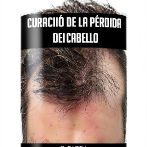 Spanish Hair Loss Prevention Guide for Men-0